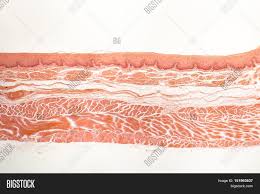 Maybe you would like to learn more about one of these? Human Esophagous Image Photo Free Trial Bigstock