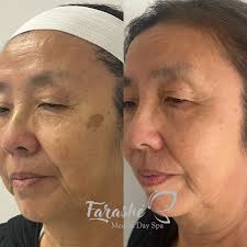 Reviews of Farashe Med & Day Spa