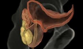 Exista o serie de boli ale testiculelor care sa afecteze calitatea si cantitatea spermatogenezei si sa cauzeze astfel infertilitatea. Afectiunile Prostatei Influenteaza Negativ Viata Sexuala Cele Mai Frecvente Boli Ale Prostatei Medlife