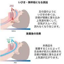 舌用マウスピース 舌ピタ いびき対策 睡眠時の騒音 無呼吸症候群 口呼吸 いびき防止グッズ ランキング 専用 歯ぎしり対策 小型 軽量 旅行 いびき対策 歯ぎしり いびき
