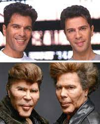 Les Freres Bogdanov Avant Apres Ils Etaient Beaux Ils Sont Devenus Fantasmagoriques