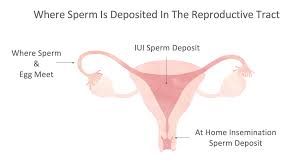 After about a week following the procedure, your doctor may want to check your progesterone levels and your uterine lining with an ultrasound. Insemination Approaches For Lesbian Women Fertilityiq