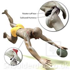 Image result for Fall on Shoulder