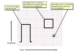 Image result for Electrocardiogram Validity