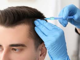 زراعة الشعر بالرياض تكلفة زراعة الشعر في أدمة زراعة الشعر الإيطالي في الرياض معلومة