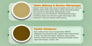 Pengusaha orkid mengunakan jaring teduhan berwarna hitam dengan kadar teduhan sebanyak 20% bermaksud jaring teduhan menapis cahaya yang diperlukan orkid mengikut keperluan. Bab Bayi Warna Hitam Kehijauan