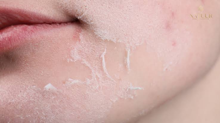 Reduces Dryness