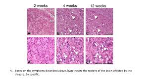 Ayrıca gün içinde kaydedilen en düşük ve en yüksek seviyeleri takip edebilir, bir önceki günün kapanış fiyatına bakabilirsiniz. Solved Exercise 3 Kuru Disease Prion Diseases Affect The Chegg Com