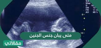 متى يبان جنس الجنين وسائل معرفة نوع الجنين مقالاتي