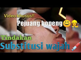 Treatment of retarded ejaculation with psychotherapy and. Video Bopeng