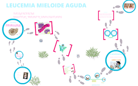 La cirugía y la radioterapia no son tratamientos principales para la aml, pero pueden utilizarse en circunstancias especiales. Leucemia Mieloide Aguda By Paula Herrera