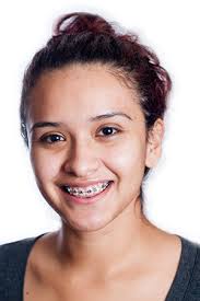 These values can help you match the specific shade you are looking for and even help you find complementary colors. Braces Portland Or Pediatric Dentist Portland Or