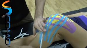 Vendaje Neuromuscular Rodilla Inflamada Kinesiology Taping Inflamacion Youtube