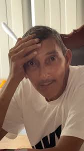 Napo una semana después del tratamiento!