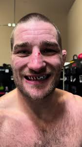 Sean O'Malley's Dad Orders Last Minute Custom Mouthguard