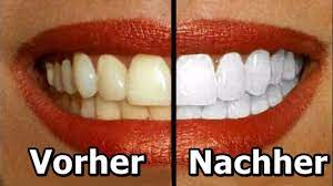 Ein esslöffel) für etwa 20 minuten im mund umher und spuckst es danach aus. 5 Naturliche Hausmittel Die Deine Zahne Aufhellen Youtube