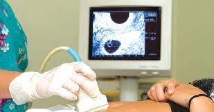 Fibroid ketika hamil boleh menjadi punca rahim bermasalah untuk mengecut. Wanita Subur Berisiko Fibroid