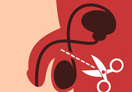 Image result for Vasectomy