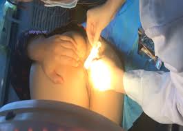 Anoscopy Examination - ThisVid.com