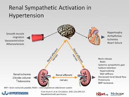 Image result for Resistant Hypertension