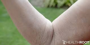 It contains beta carotene, protein, lecithin, fatty acids, and vitamins a, d, and e, which could all help moisturize the skin and protect it from uv rays. Get Rid Of Crepey Skin 7 Unique Remedies