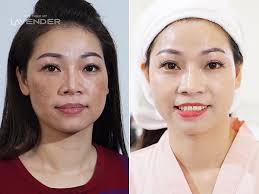 Kết quả hình ảnh cho HÌNH ẢNH TRỊ NÁM CON GÁI