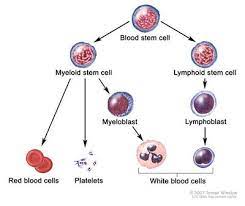 Some people with multiple myeloma, especially those with early stages of the condition, have no concerning signs or symptoms. Multiple Myeloma Physiopedia