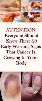 A painless one is a possible warning sign of testicular cancer. Health Body Health Cancer Sign