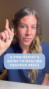 Podiatrist Dr. Emily Keeter shares her go-to products for healing cracked  heels #Podiatrist #DoctorsOfTikTok #FootCare #SelfCare #CrackedHeels  #PedestrianProject