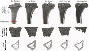 Single, prepared microscope slide of cross section and longitudinal section of a bone. Plos One Effects Of Multi Deficiencies Diet On Bone Parameters Of Peripheral Bone In Ovariectomized Mature Rat