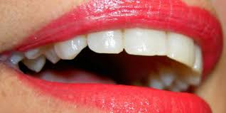 El blanqueamiento dental es un procedimiento estético que debe ser realizado y supervisado por un odontólogo. Como Blanquear Los Dientes De Forma Natural Foro Libre Hello Foros La Comunidad En Espanol Mas Popular De Los Latinos