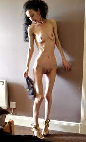 Anorexic Girl Nudes - 64 photos