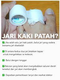 Mangsa, muhammad azuan iqbal abdullah sani, 23 berkata dia hanya menyedari kejadian itu selepas ibu jari kanannya bengkak selain beberapa kesan berwarna hitam sejak dua. Share Tips Kecederaan Jari Kaki Public Health Malaysia Facebook
