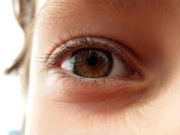 Image result for Eye Pain