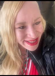 Photoshop requests for albinism portraits