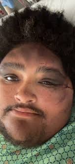 Fundraiser by Courtney Ingram : Shane's Fight: Support His Healing Process