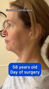 Day 1 of a journey. (Reposting Margot!)Margot is a young 58 and she’s  incredible!She is a fit, energetic commercial pilot and is fascinating to  talk to. She has also been watching my videos for about ...