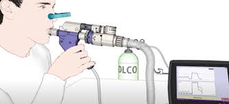 Image result for Diffusing Capacity