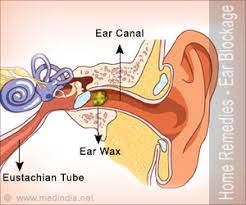 With plugged ears, your eustachian tubes — which run between your middle ear and the back of your nose — become obstructed. Home Remedies For Ear Blockage Simple Tips To Curb Ear Blockages