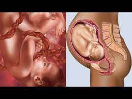 Semana 35 De Embarazo 8vo Meses Desarrollo Del Bebe Embarazo Semana A Semana Youtube