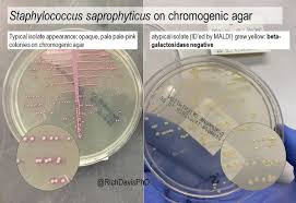Image result for Staphylococcus Saprophyticus