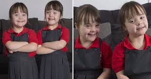 Parents Are Proud Of Their Identical Twins With Down S Syndrome As They Say There S Nothing Negative About Them Small Joys