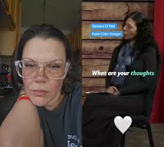 Barbara O Neill Corn Removal