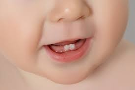 Etwas später beginnt das zahnen der backenzähne, die etwa um den ersten geburtstag zu erwarten sind. Zahnen Wenn Babys Erste Zahne Kommen Symptome Hilfe