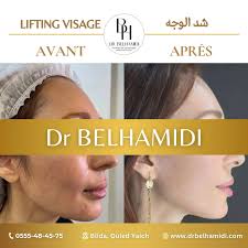 chirurgie et médecine esthétique Blida