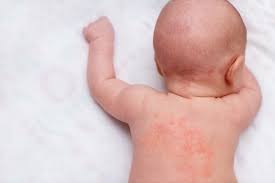 We did not find results for: Trockene Babyhaut Ursachen Und Die Richtige Pflege