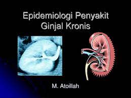 Gagal ginjal adalah penyakit yang menyerang bagian ginjal dan terkategori ke dalam beberapa kondisi yaitu gagal ginjal akut dan kronik. Ppt Epidemiologi Penyakit Ginjal Kronis Powerpoint Presentation Free Download Id 3359271
