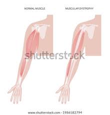 In fact, there are simple machines within the body's component parts. Shutterstock Puzzlepix