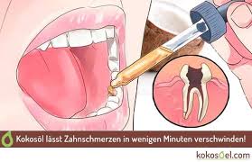 Nelken Und Kokosol Bei Zahnschmerzen Die Naturliche Erste Hilfe Rezept Zahnschmerzen Zahne Kokosol