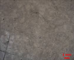 The ee20 engine had an aluminium alloy block with 86.0 mm bores and an 86.0 mm stroke for a capacity of 1998 cc. Opinion We Are All Plastic People Now In Ways We Can T See And Can No Longer Ignore The Globe And Mail